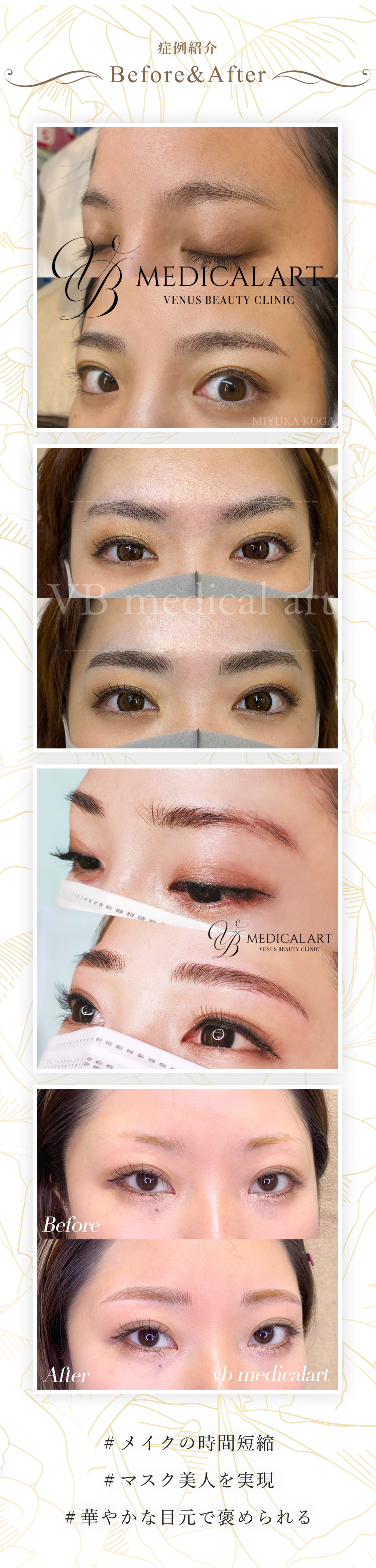 MEDICAL ART】アートメイクは新宿・銀座のVENUS BEAUTY CLINIC